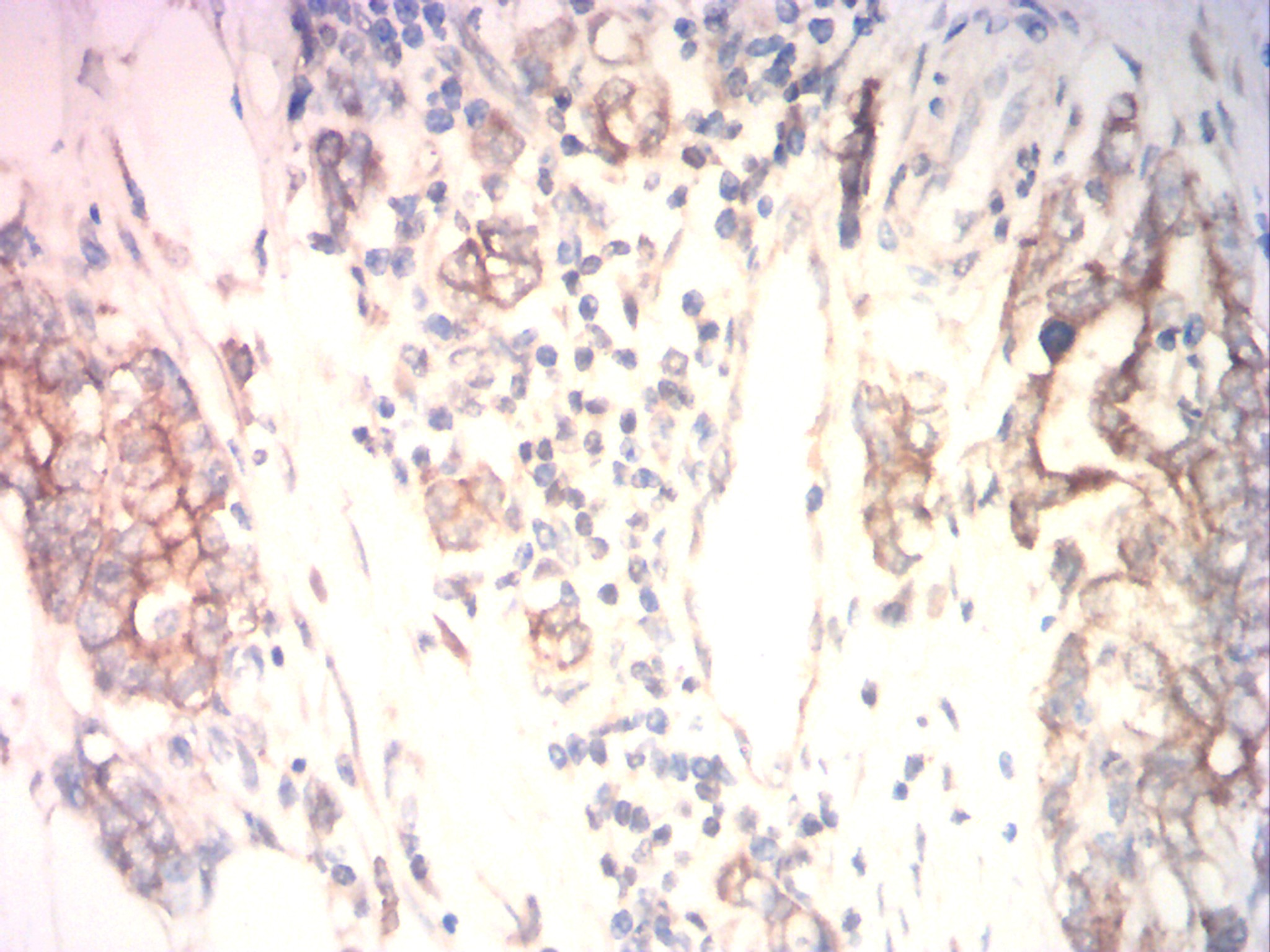 IHC